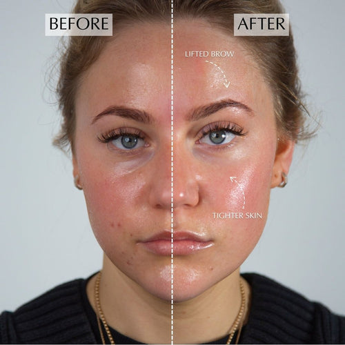 Expert Facials on Demand – ZIIP UK