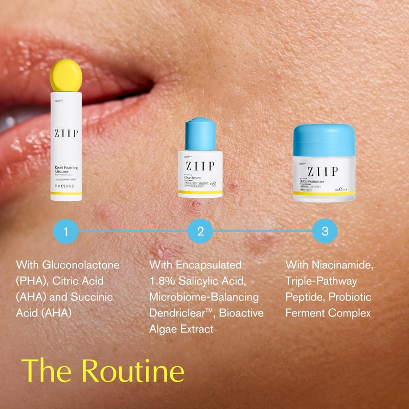 Spot Control Complete Routine
